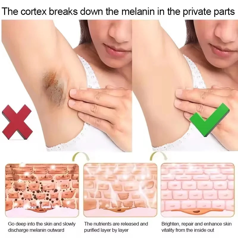 Whitening Cream Private Parts Underarm Butt Knee Whiten Inner Thigh Intimate Parts Dark Remove Melanin Woman Brighten Skin Care - GilloServ