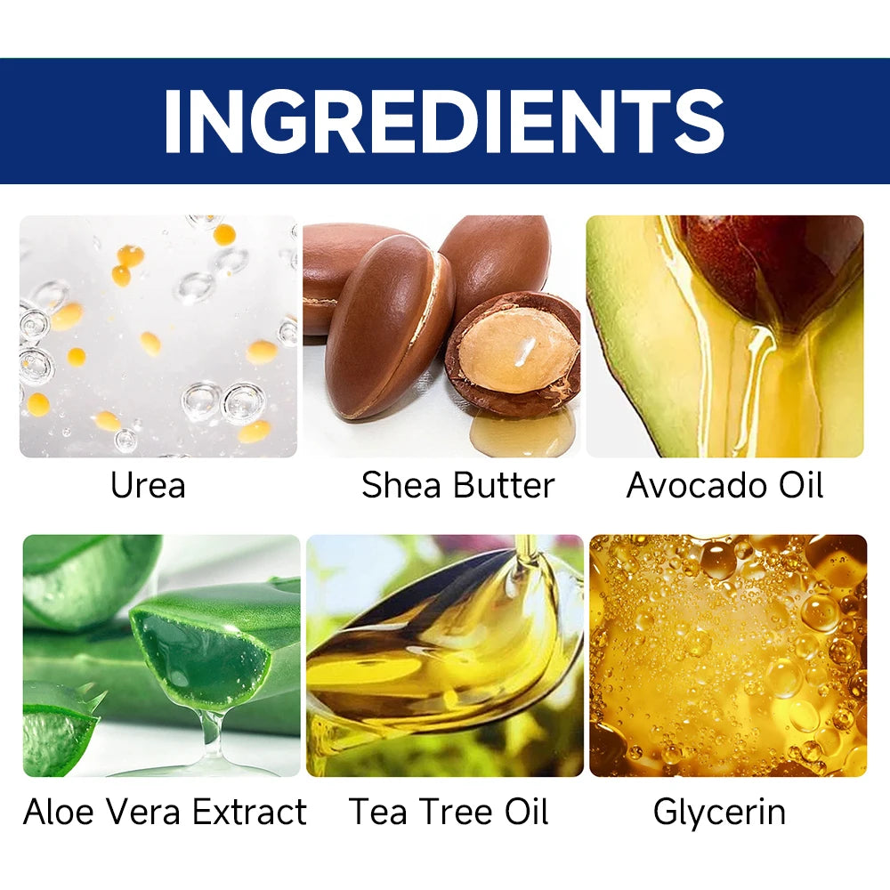 60% Urea Foot Cream for Cracked Heels & Dry Skin - Intensive Moisturizing Treatment, Callus Remover, Diabetic Foot Care. - GilloServ